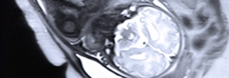 OA research in the news: Using MRIs for fetal scans